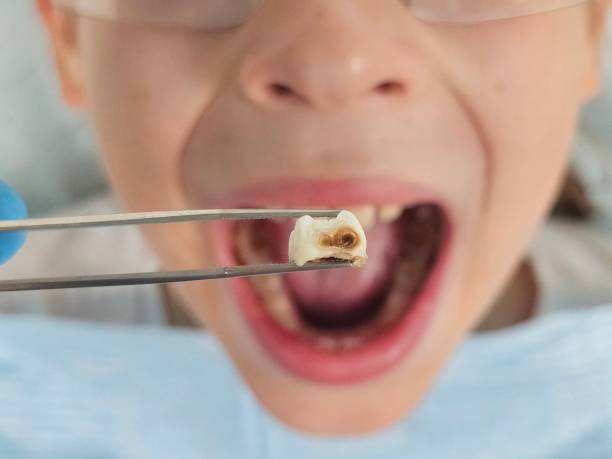 Emergency Gum Pain Relief in MI